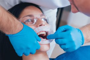 Emergency Root Canal Therapy in Oakville