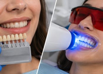 A split-screen image comparing dental veneers vs teeth whitening.