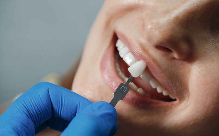  Can You Straighten Teeth With Crowns? A Complete Guide