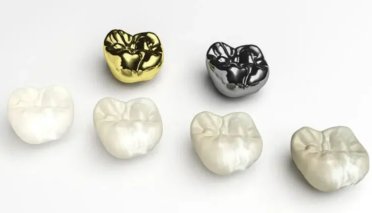 Types of Dental Crowns