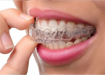 Chewing Gum with Invisalign