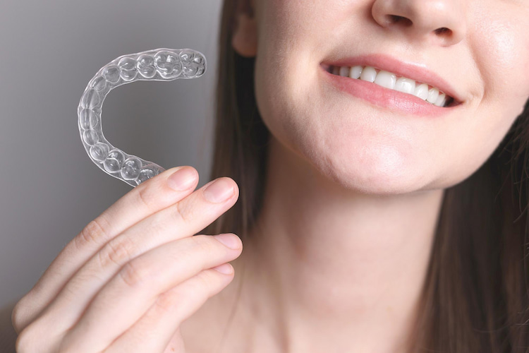a woman has a set of Invisalign in her hand.