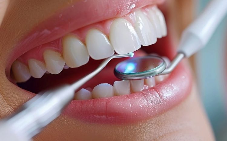  Everything You Should Know About Front Tooth Implants