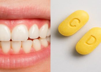 Healthy gums and teeth with vitamin C and D pills, showing vitamins for gums and teeth.
