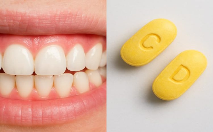  What Vitamins Are Good for Your Gums and Teeth?