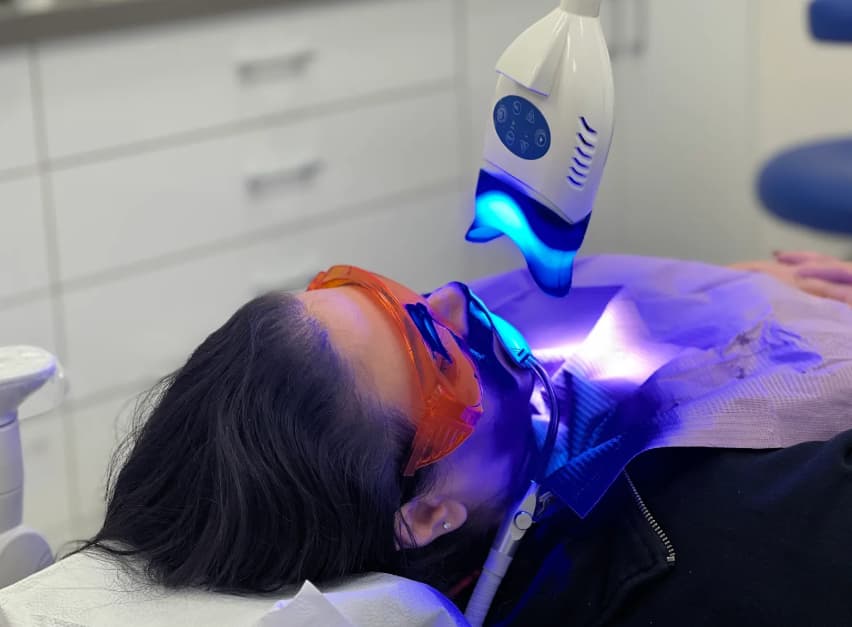 Teeth Whitening Oakville