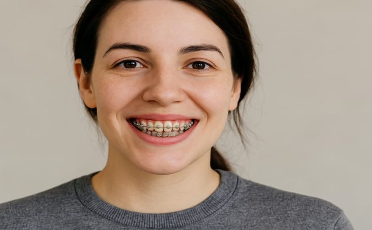  How Much Do Braces Cost in Canada? 3 Best Offers For You