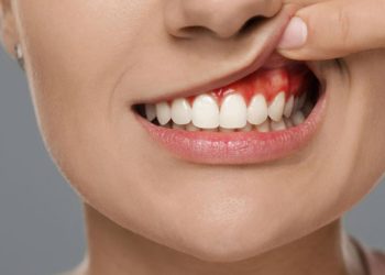 how to treat dental abscess