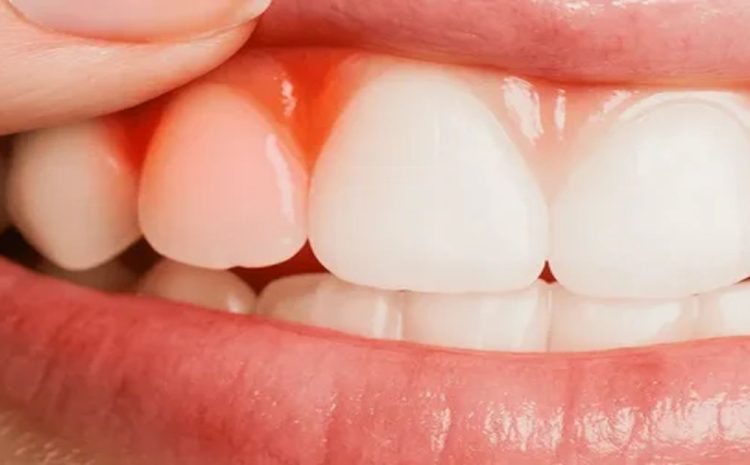  What is the Best Antibiotic for Gum Infection?