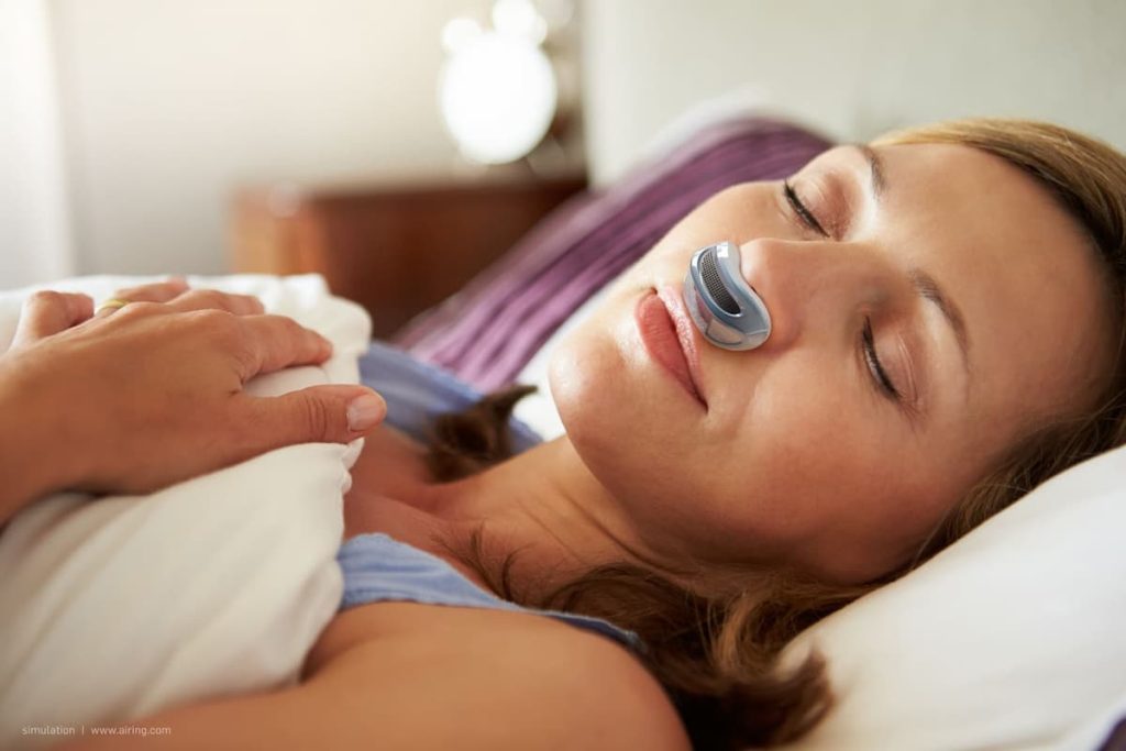 Sleep Apnea Treatment