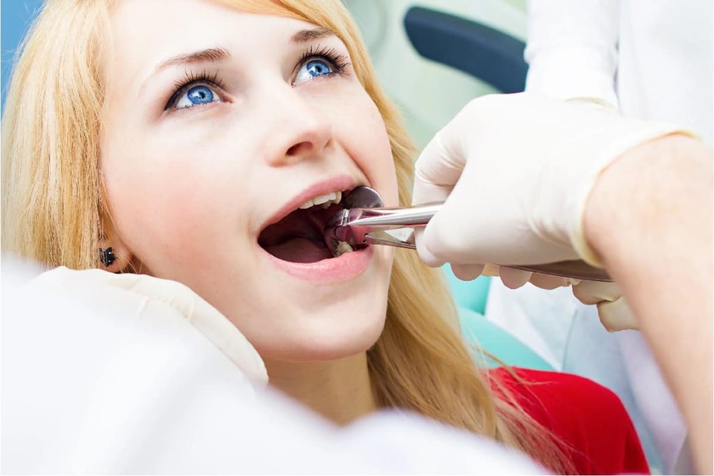 Tooth Extraction in Oakville