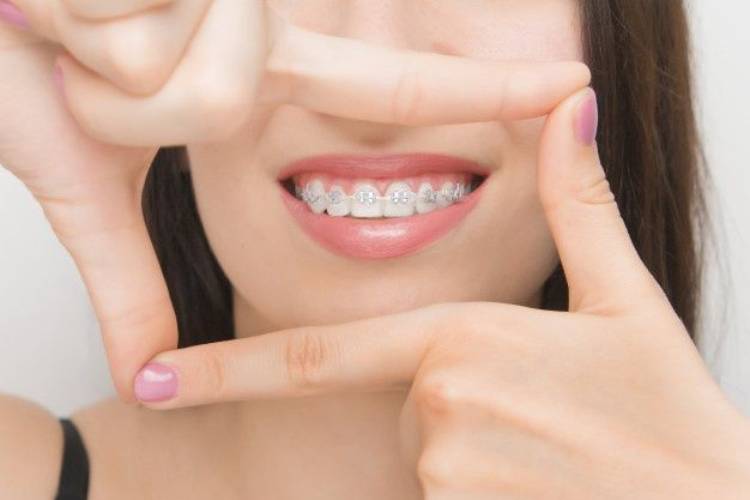 CDCP braces; all things you must know