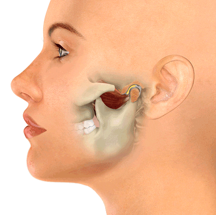 What Is TMJ? Understanding Temporomandibular Joint Disorder