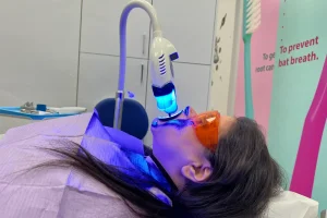 How Is the Teeth Whitening Procedure Performed?